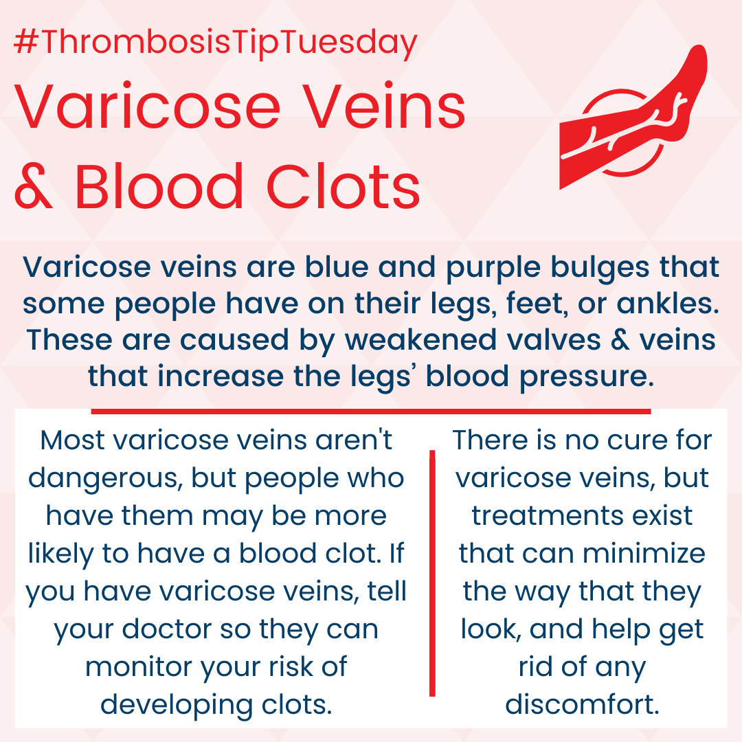 thrombosis tip varicose veins