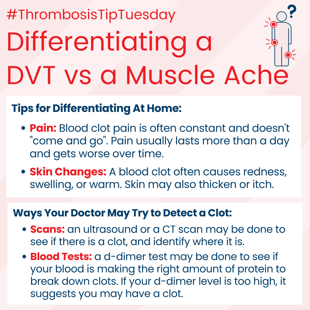 DVT vs Muscle Ache Tip image